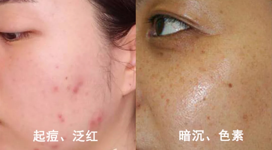 国货美白淡斑精华液,国货美白补水淡斑