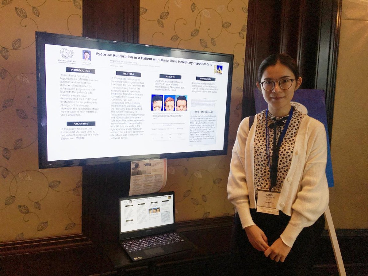 米诺地尔有什么副作用吗,米诺地尔副作用和禁忌