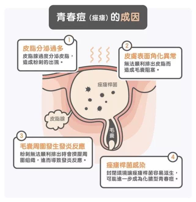 青春痘和脓疮痘有什么区别,青春痘痤疮的最佳治疗方法