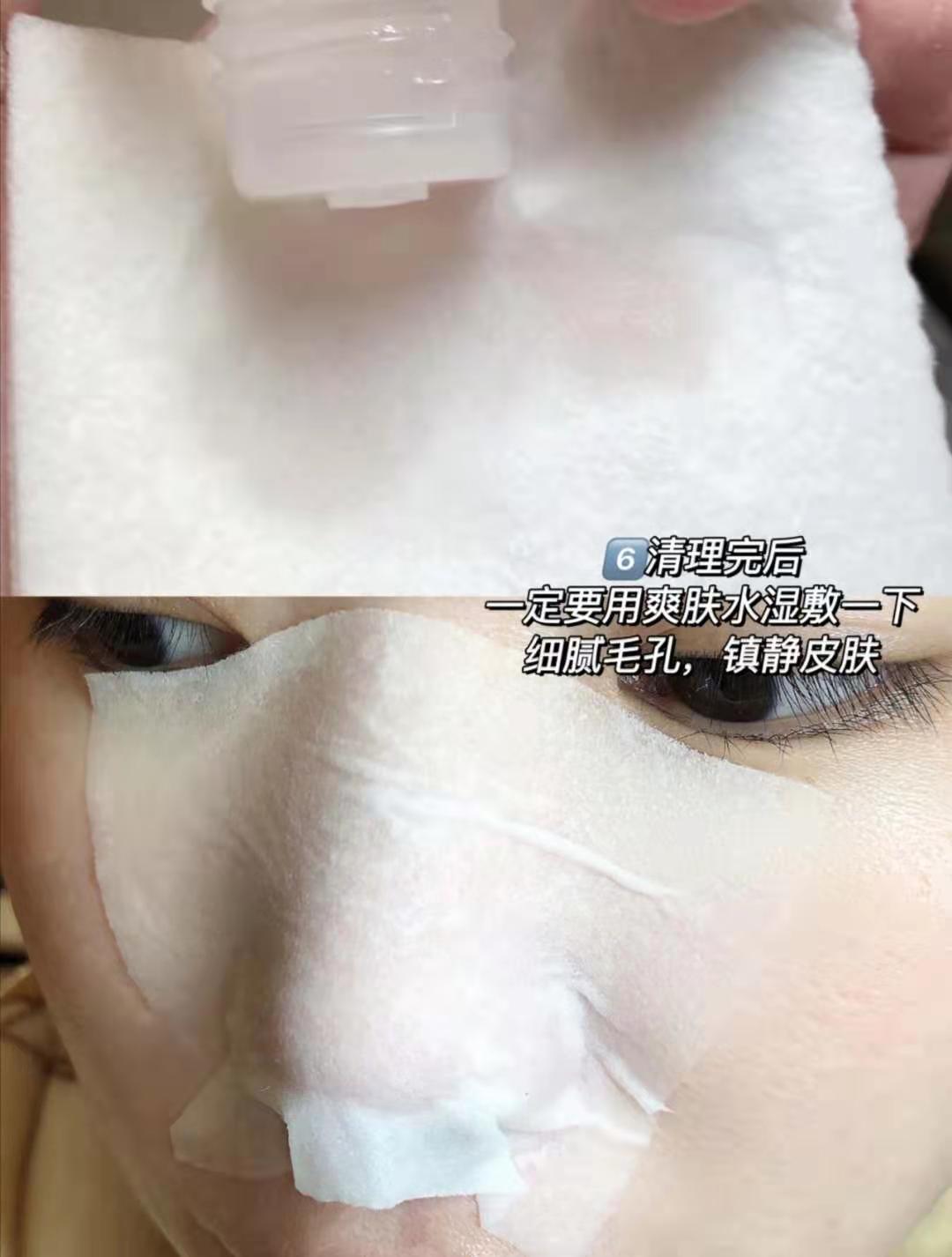 去黑头收缩毛孔测评,去黑头收缩毛孔什么牌子好