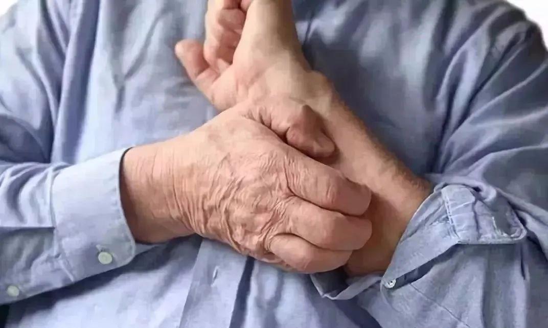 急性发热性嗜中性皮病病程多久,急性嗜中性发热性皮病不能吃什么