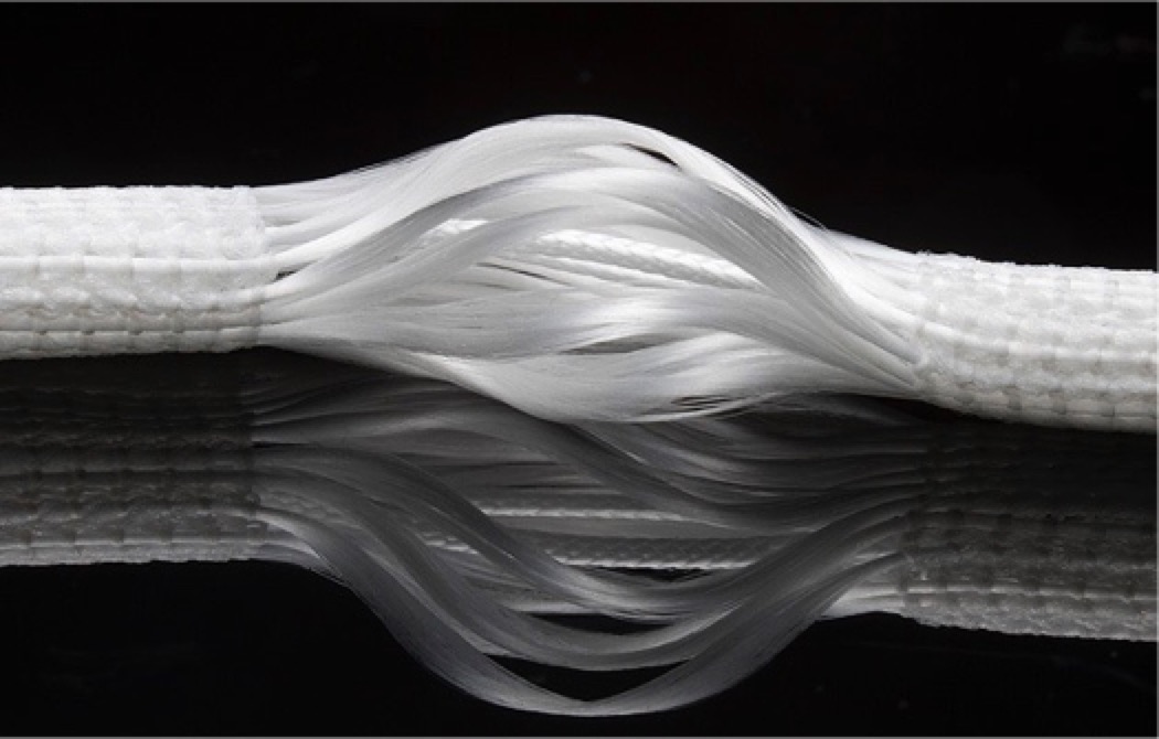 前叉重建单束可以满足运动要求么,前叉重建有几个切口