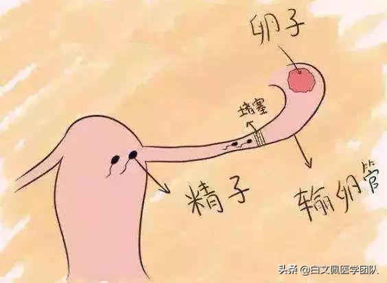 不爱怀孕有好办法吗,不爱怀孕