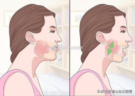 「译文分享」头颈姿势与颞下颌关节疼痛的关系