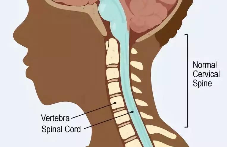 “减负”太遥远,现在我只想保住孩子的颈椎