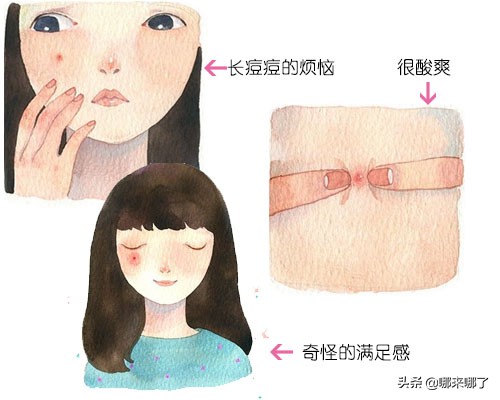 成人痘最有效治疗方法,怎样根治成人痘