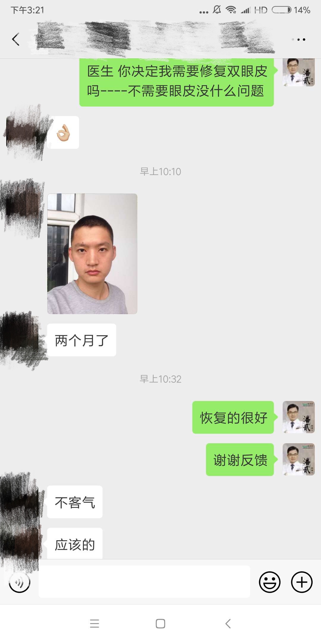 开内眼角会留疤的照片,开内眼角的疤痕变白色了怎么办