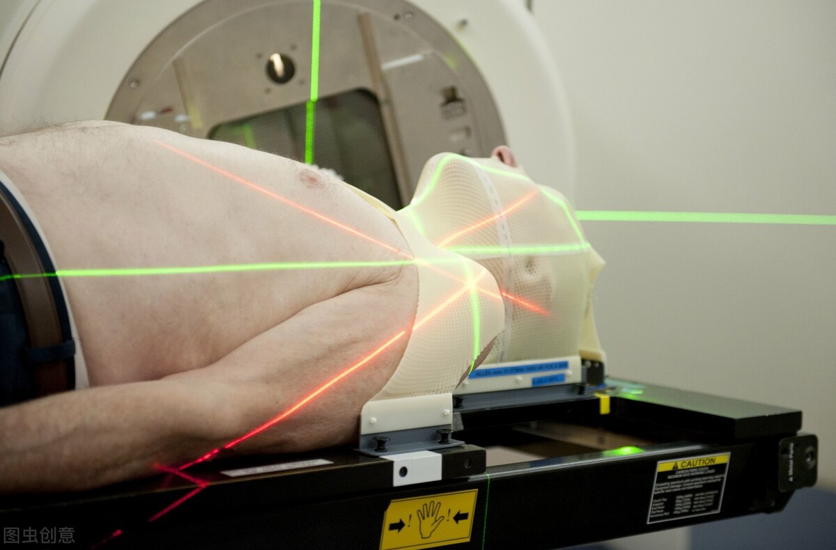 放疗期间可以洗澡吗,食道癌放疗能洗澡吗