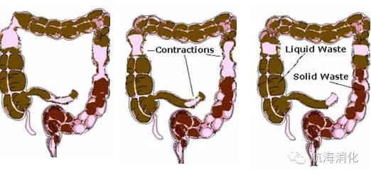 47岁女性便秘总是感觉肠道有气,35岁经常便秘需要做胃肠镜吗