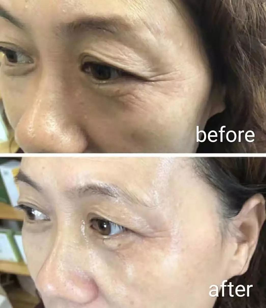 一年四季都能用的保湿面霜,皮肤干推荐一款好用的面霜