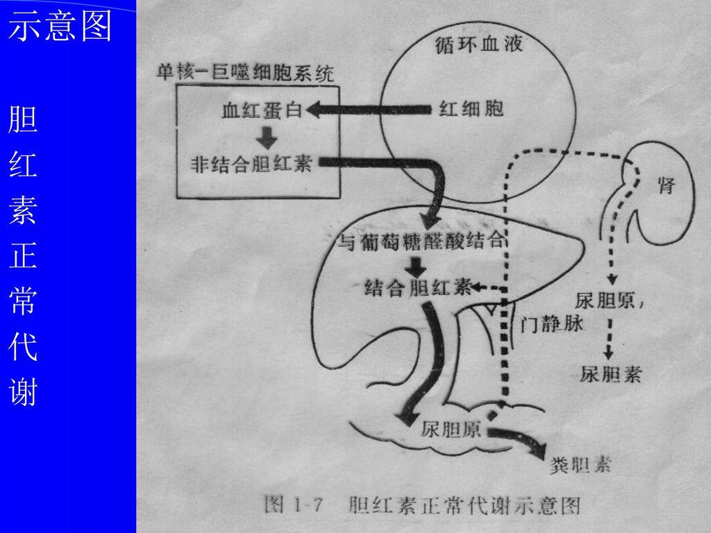 胆囊切除后容易得肠癌吗,胆囊切除术后容易得肠癌吗