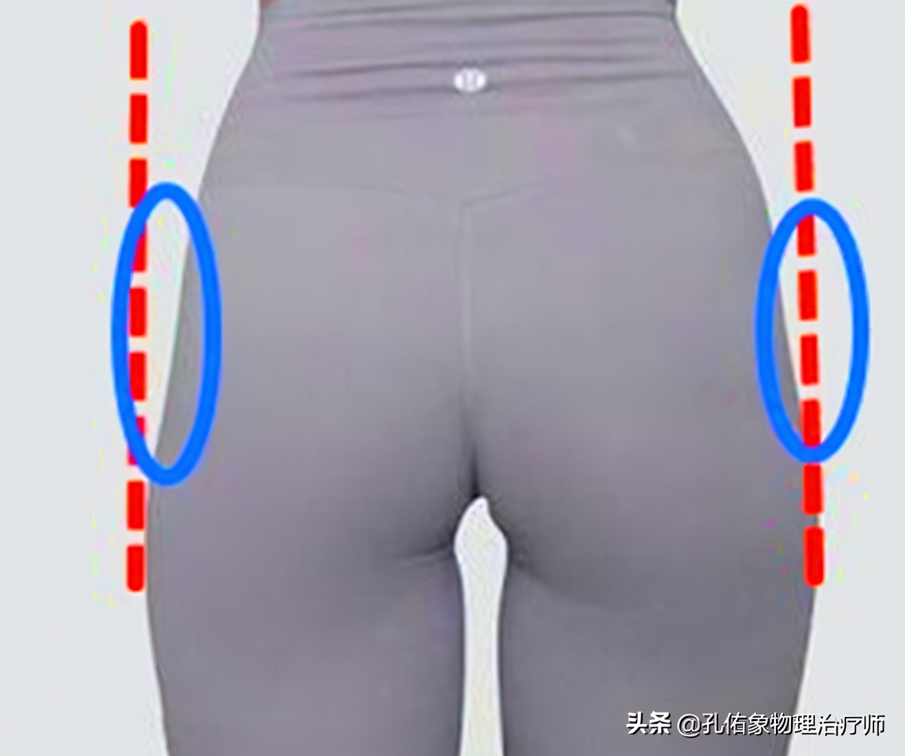 久坐右边臀部疼痛发麻怎么锻炼,久坐臀部疼痛怎么锻炼