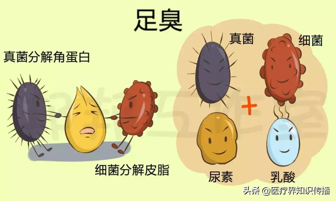 脚气能治好吗可以彻底治愈吗,脚气用酒精或碘酒擦拭可以治愈吗