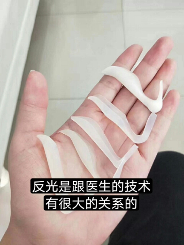 硅胶隆鼻会透光么,硅胶隆鼻会出现骨吸收的问题吗