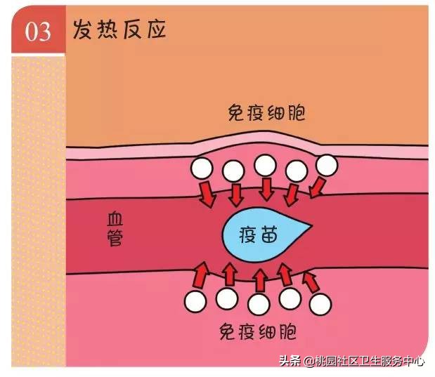 打完乙肝疫苗胳膊硬块红肿疼痛,打完脊灰疫苗后注射部位疼痛红肿