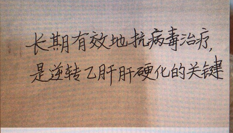 肝硬化的脾脏厚度多少 (乙肝肝硬化脾脏厚度约60mm严重么)