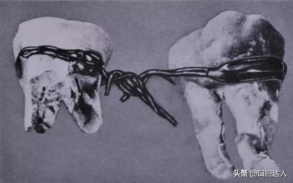 最全的牙科历史发展，牙医们大喊惊讶