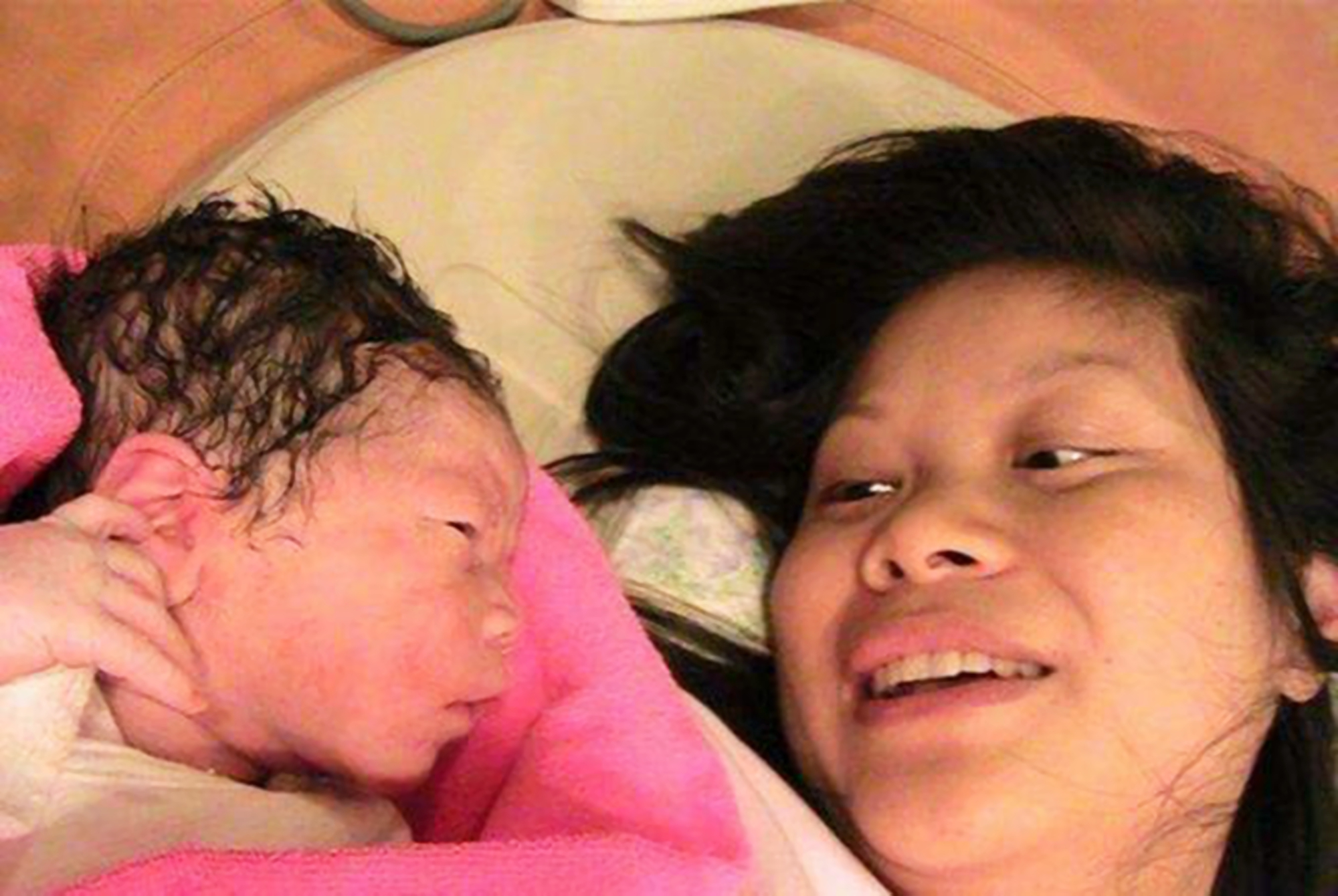 宝宝成为小秃瓢这4个原因要了解,宝宝头发有斑秃是什么原因