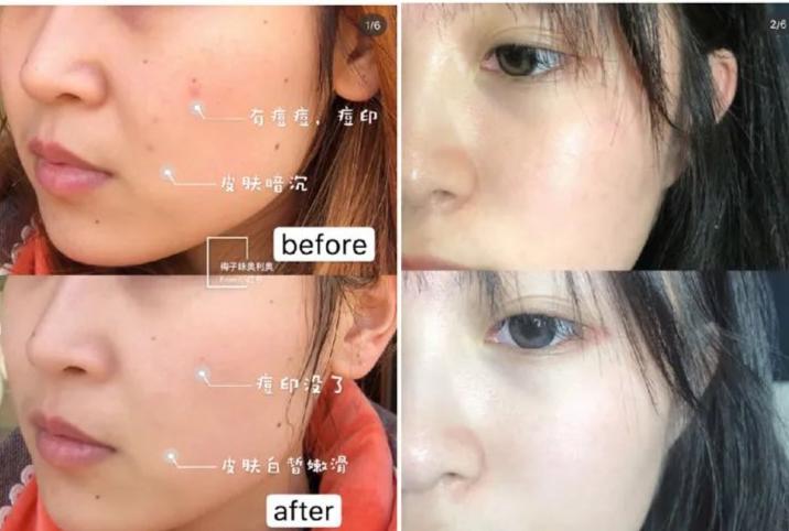 死海泥洗面膜怎么样,死海泥面膜的神奇功效是什么