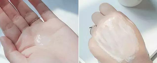 泛红期的红血丝怎么治疗,泛红的红血丝几天能好