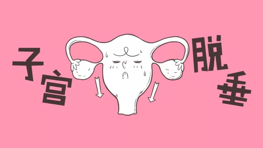 女性产后子宫脱垂严重,锻炼核心可以预防子宫脱垂吗