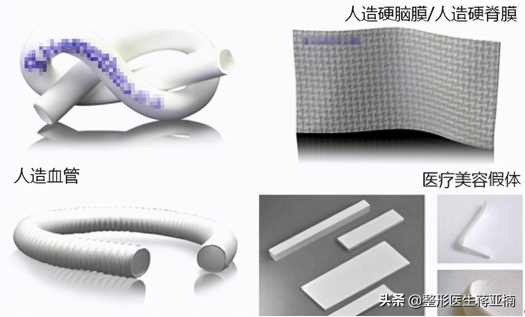 膨体隆鼻感染的症状是什么,膨体隆鼻感染不取出不行吗