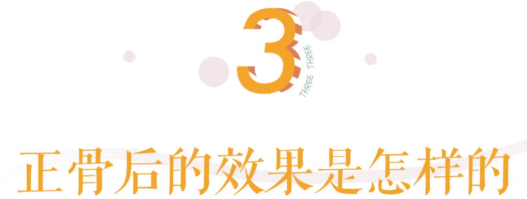 明星正骨后遗症,明星正骨效果明显