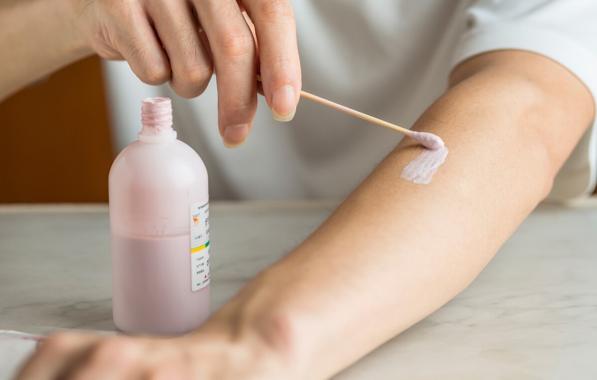 冬天皮肤特别痒怎么办,冬天洗澡后皮肤干燥又痒怎么办