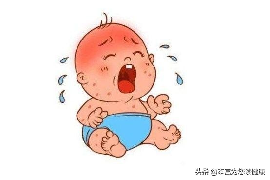 宝宝为什么会长湿疹什么原因,宝宝长湿疹的原因及解决方法