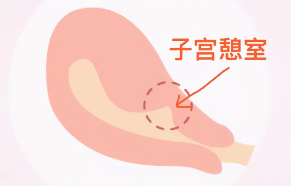 子宫恢复得不好要吃什么药,产后42天子宫没恢复好是什么原因