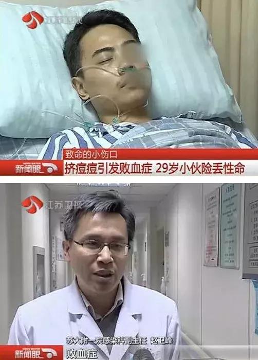 挤了一颗痘会全脸爆痘吗,挤了一颗痘半边脸麻了