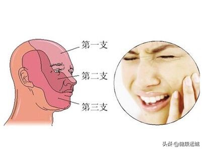 看盐湖区人民医院神经外科主任王京宽,如何降服“天下第一痛”