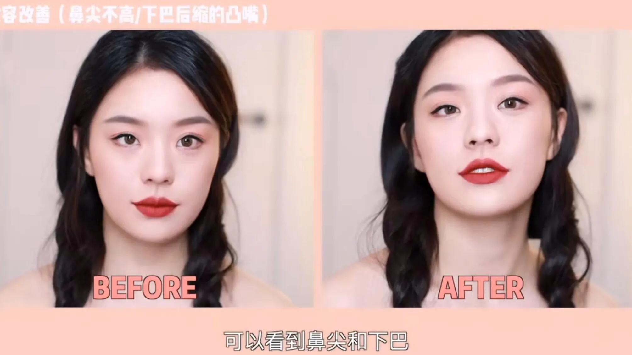 侧颜凸嘴怎么修,让侧脸变好看的方法