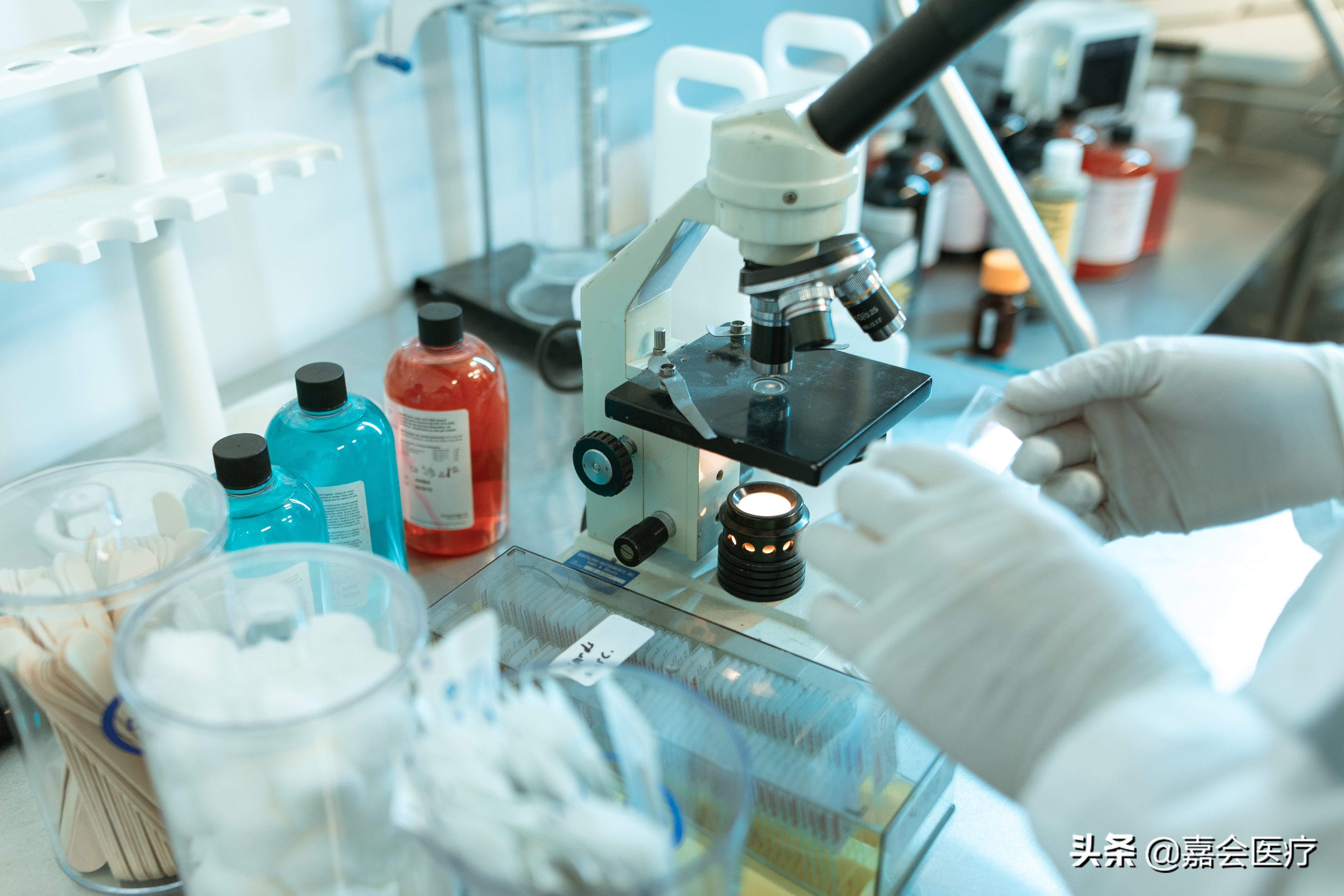 肝功能检查谷草转氨酶升高,肝功能检查转氨酶升高是什么原因