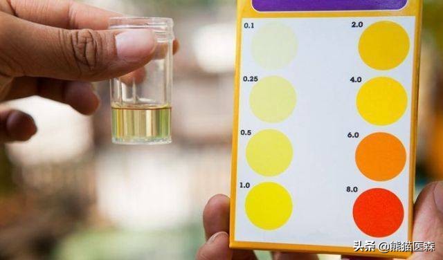 尿常规出现红细胞是胃出血吗,尿常规出现红细胞原因