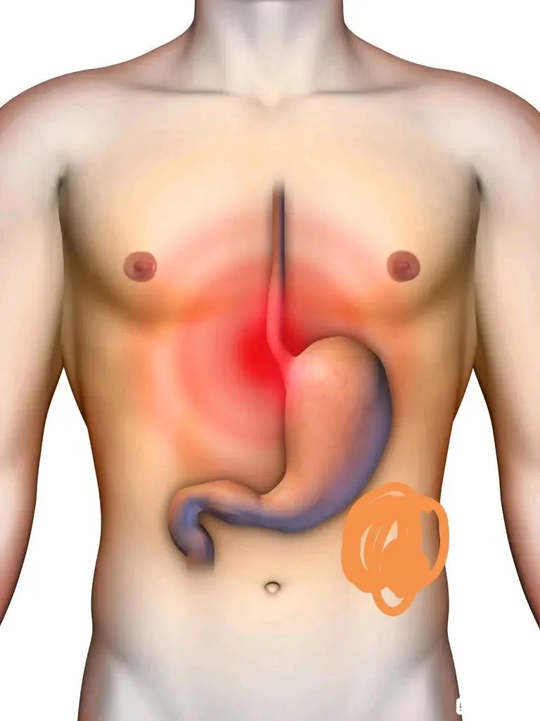 胃气要降脾阳要升是什么意思,胃气主升还是降