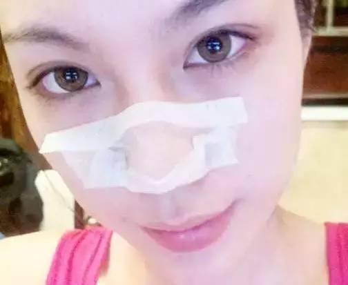 毛孔粗大、鼻子起皮是怎么引起的呢?日常护肤小常识帮你解决