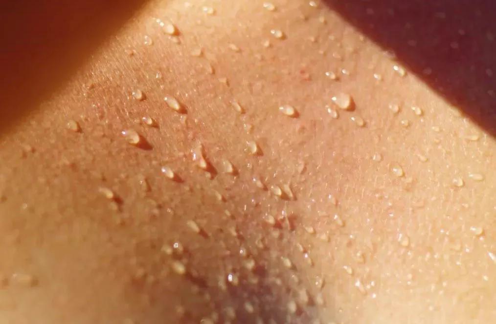 中药熏蒸和产后发汗区别,月子中心产后熏蒸发汗