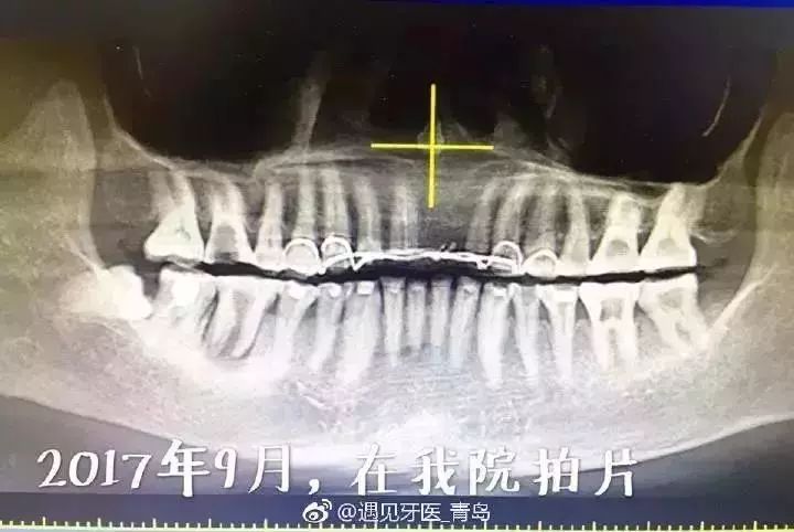 莆田系牙科坑人吗,莆田系口腔诊所曝光新闻