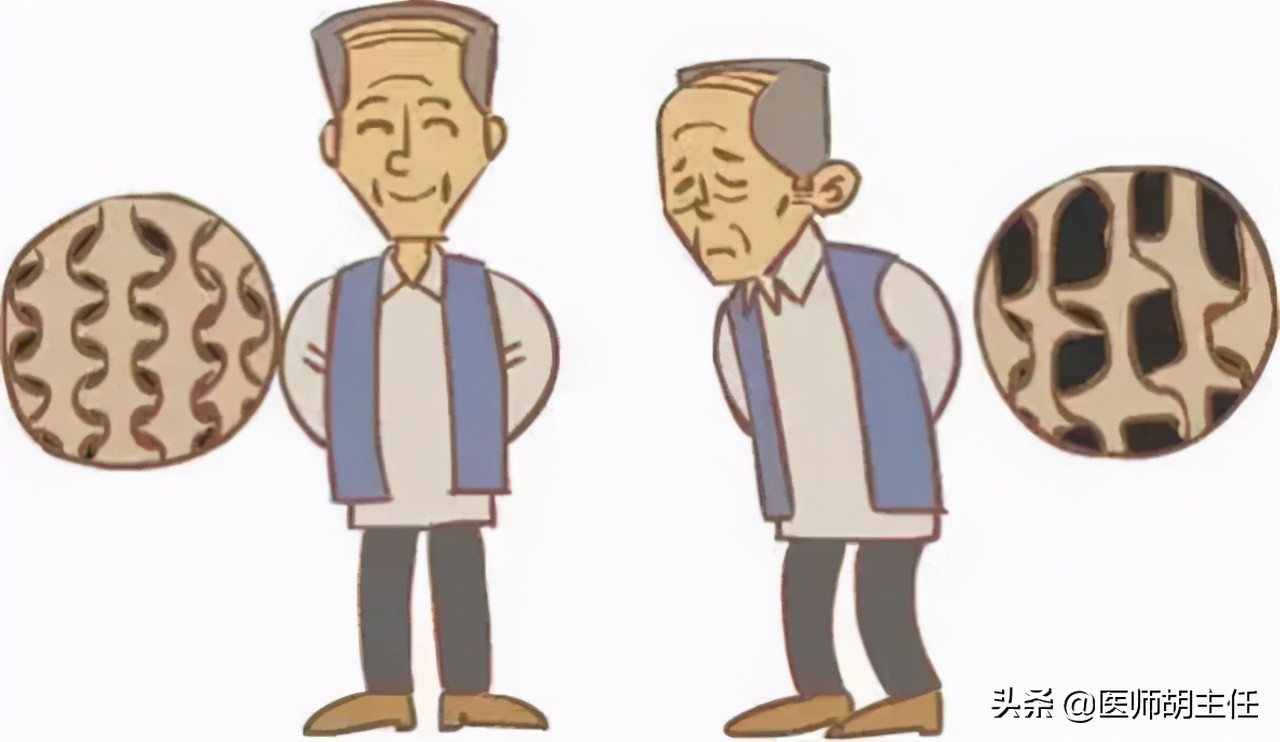 尿酸偏高又有肾结石怎么办,尿酸高引起的肾结石怎么反复发作