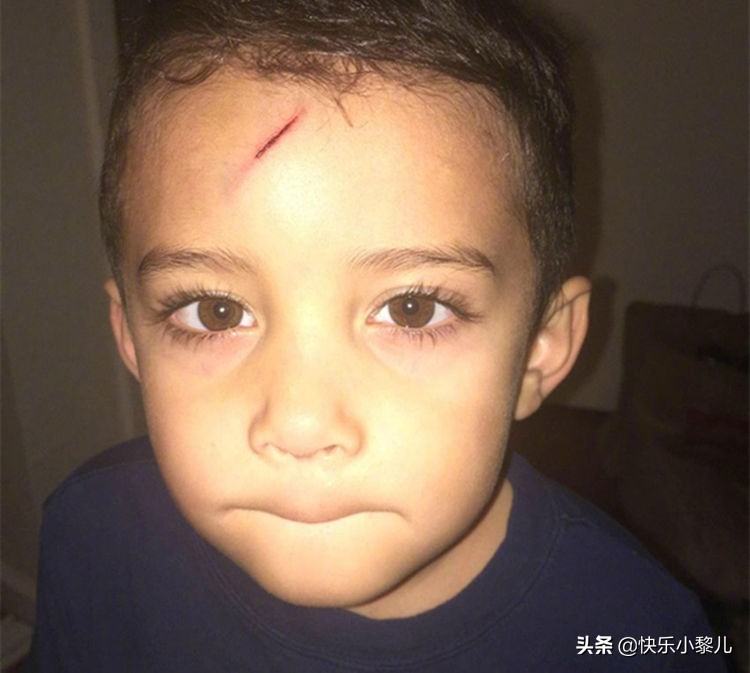 萌娃不小心撞到脑袋摔一跤,萌娃不小心撞到脑袋摔了一跤