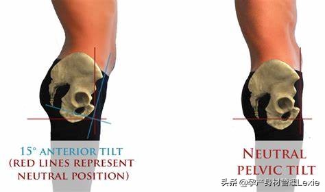 孕期为什么会出现腰痛、下背痛?真相在这里