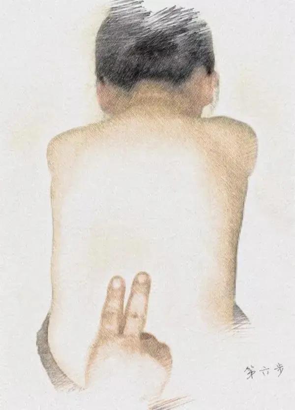 脊柱侧弯专科门诊,脊柱侧弯挂脊柱外科