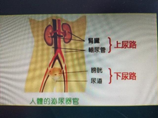 尿路感染最新指南5大要点轻松学,尿路感染真的看不好吗