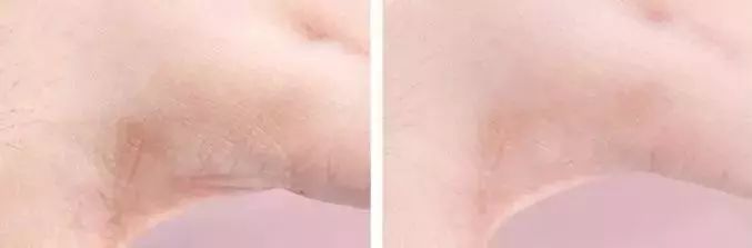 国货修护祛痘印护肤品推荐,堪比大牌平价护肤品