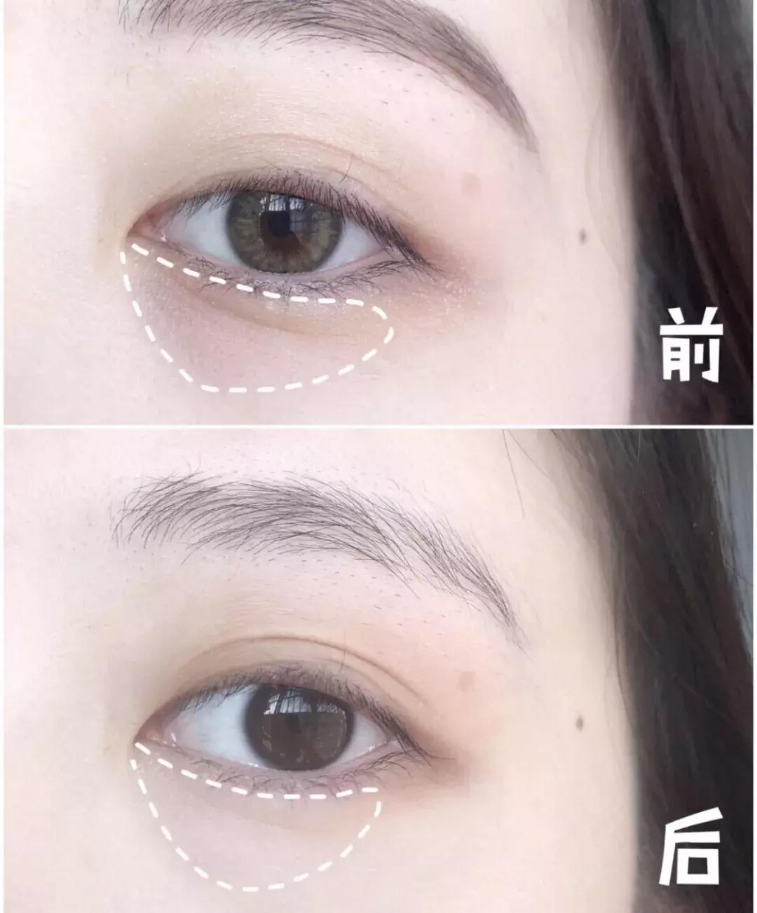 有了前法国第一夫人的百元“黑科技”眼霜，我把3000块眼霜扔了！