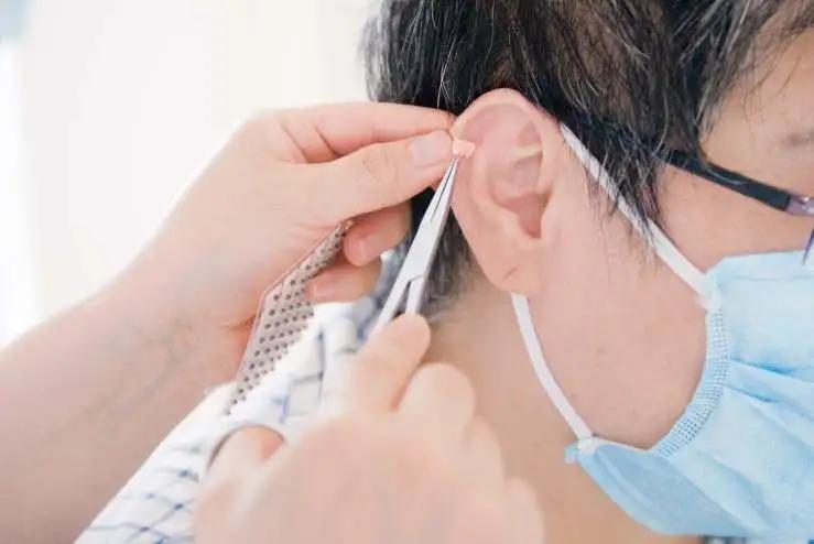 单纯性肥胖症用中医针灸怎么治疗,中医辨证针灸治疗病理性肥胖