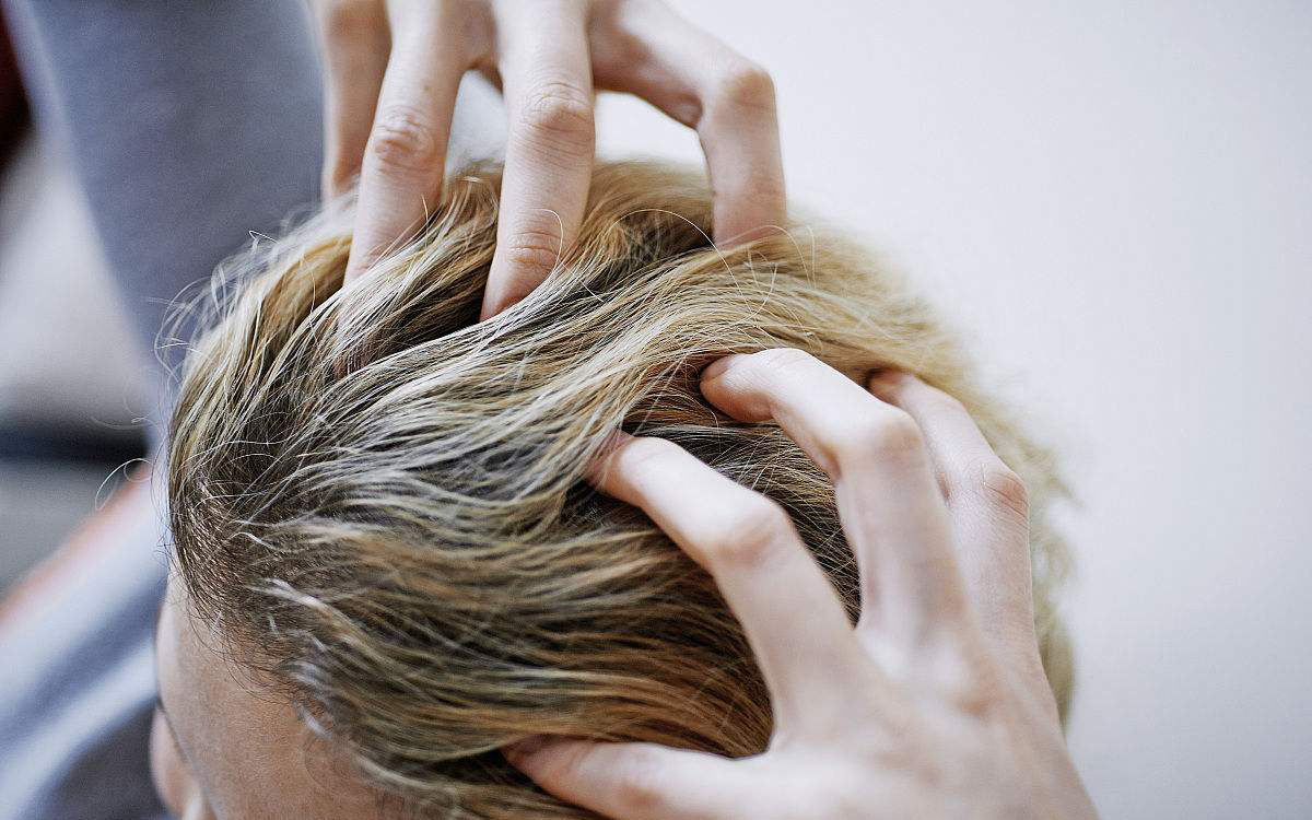 头发易出油头皮多怎么回事,头皮上有螨虫头发掉怎么办