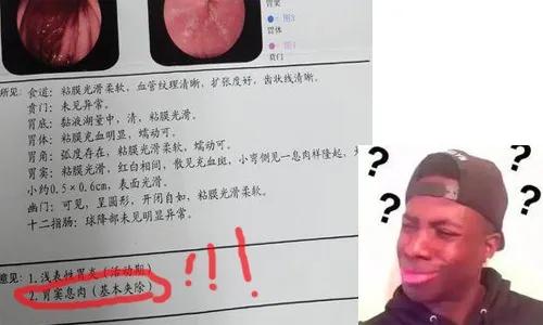 胃息肉一定能癌变吗,胃息肉会癌变吗