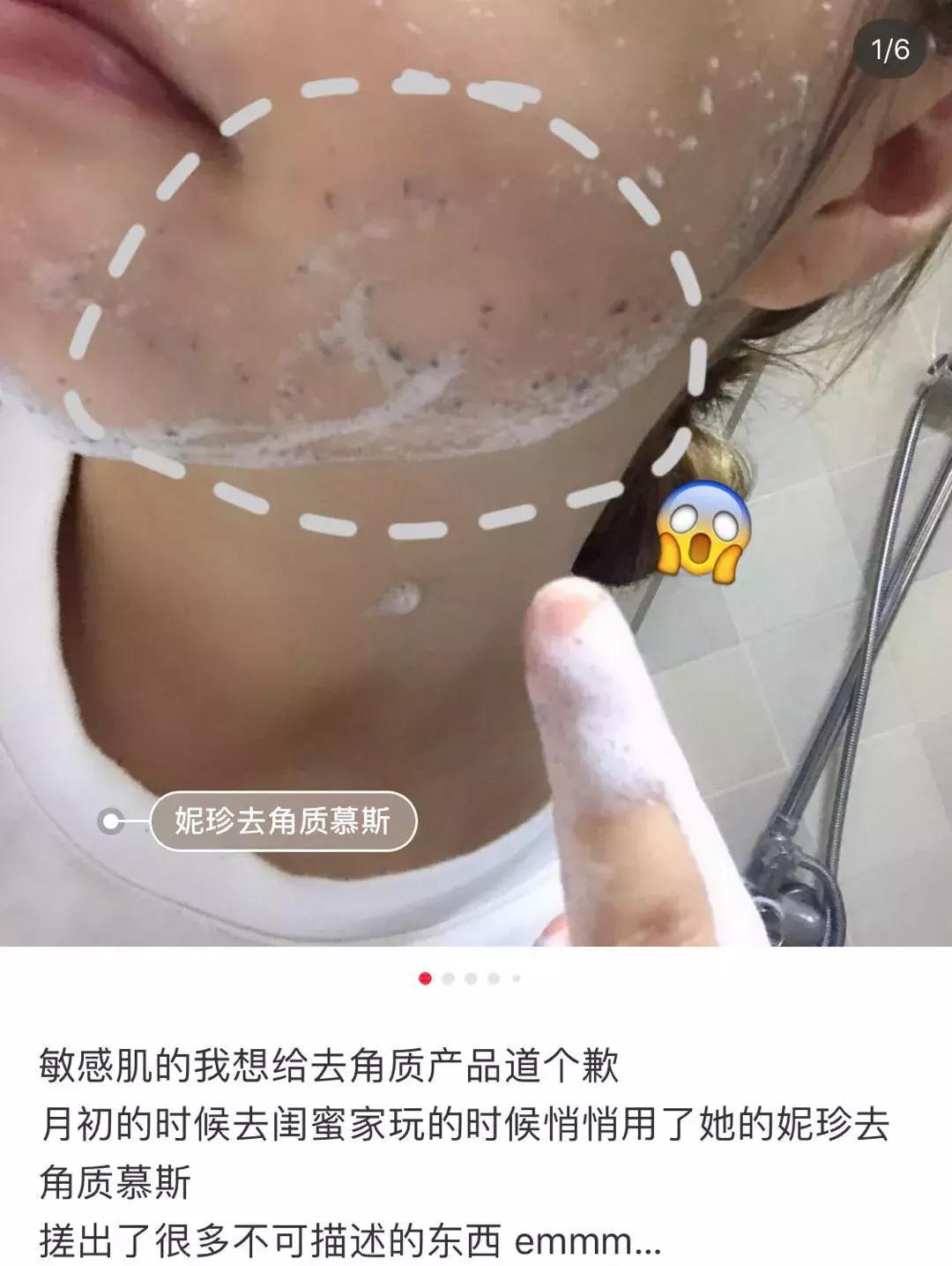 吸黑头神器去粉刺角质收缩毛孔,皮肤清洁收缩毛孔黑头角质